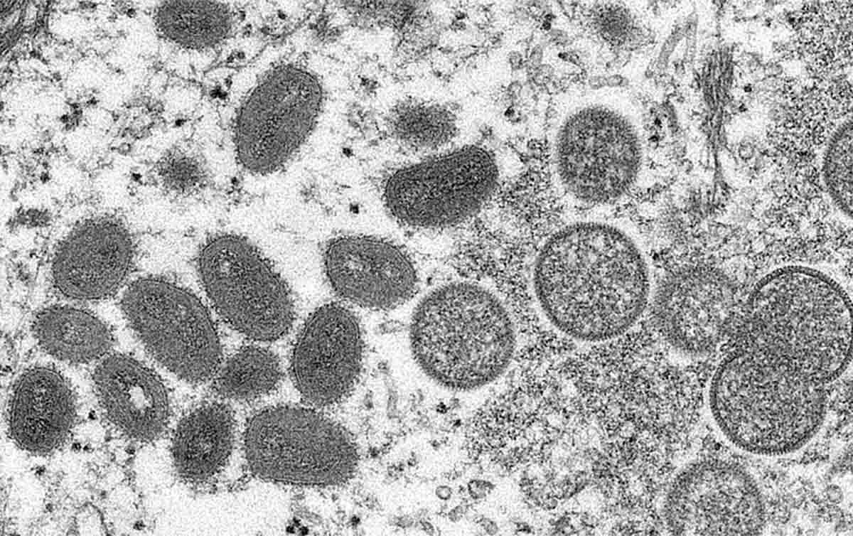 Brasil monitora casos suspeitos de varíola dos macacos, doença ‘despercebida’, diz OMS