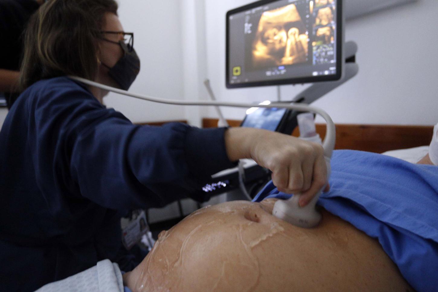 Paraná é o segundo estado com maior redução da gravidez na adolescência